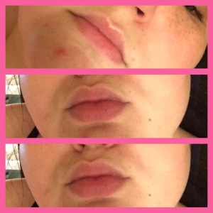 Sephora lip mask+rose lip mask+moisturizing and softening lip mask+review